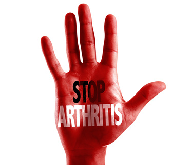 Arthritis